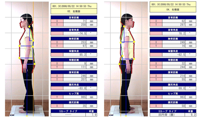 オーダーメイド枕　大阪　睡眠改善研究室の姿勢測定機