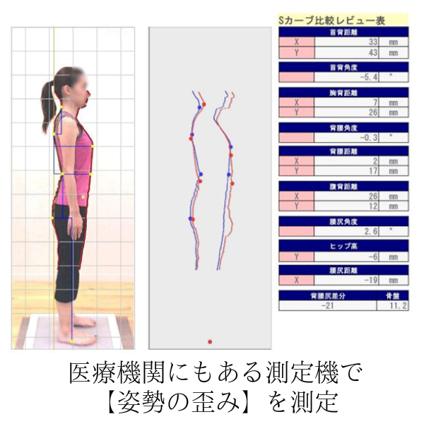 オーダーメイド枕 大阪 睡眠改善研究室の第一測定機で「姿勢の歪み」を測定